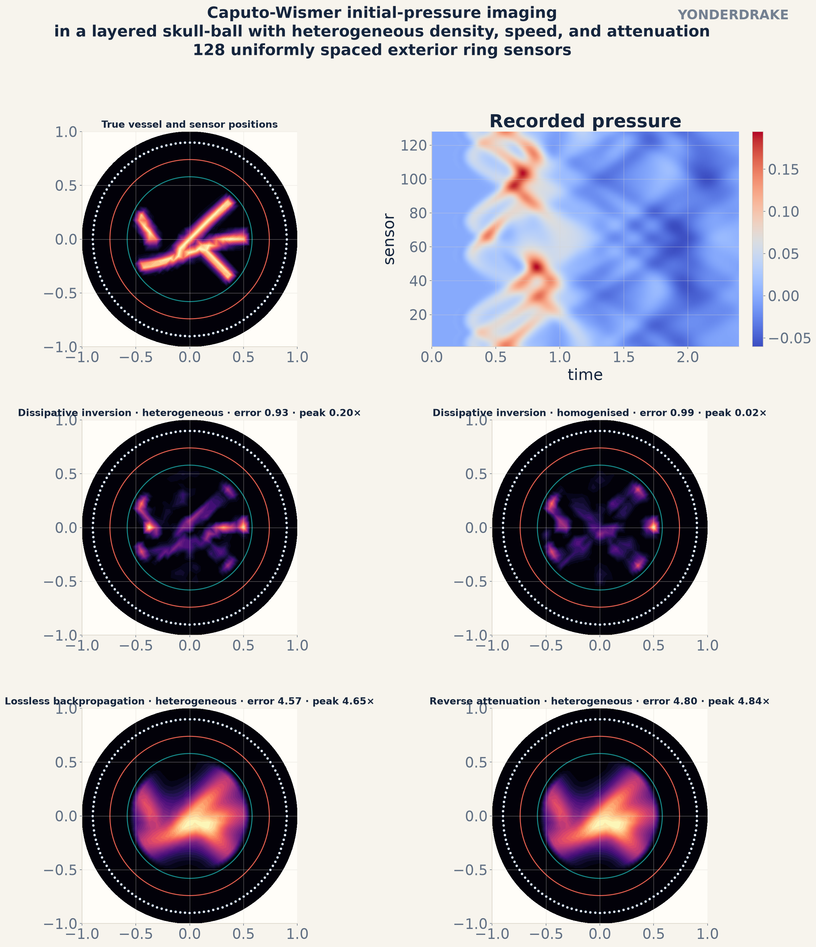 Vessel source in a layered ball, sensor pressure, attenuation-aware inversions, lossless time reversal, and regularized reverse attenuation