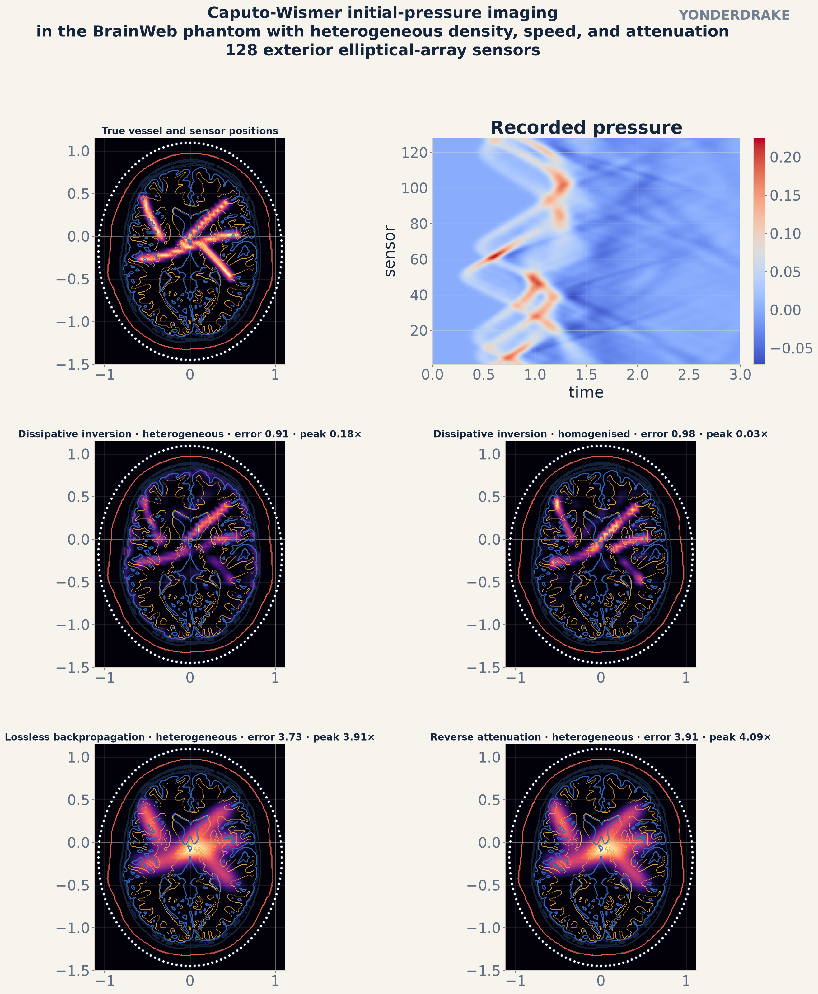 BrainWeb vessel source, sensor pressure, attenuation-aware inversions, lossless time reversal, and regularized reverse attenuation